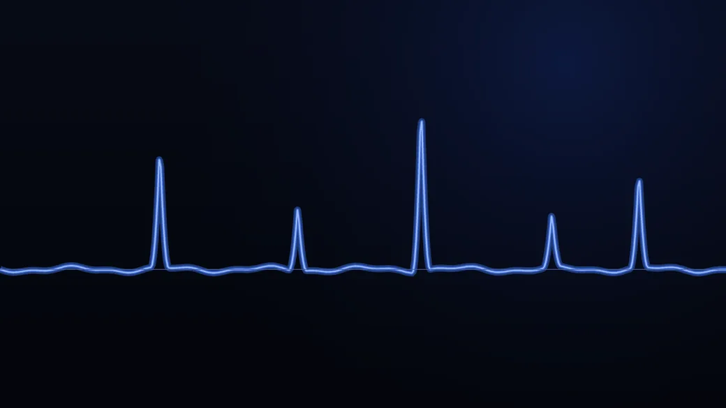 Wykres frametime biegnący płasko, z kilkoma ostrymi skokami.